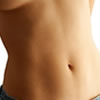 Tummy Tuck